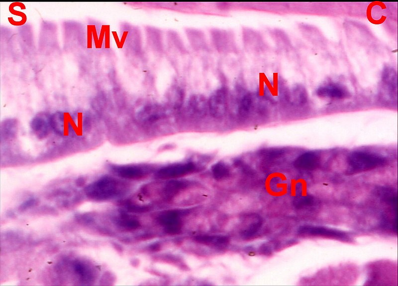 Epithelium buccal Araniella