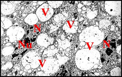 Adénocyte sexuel 1