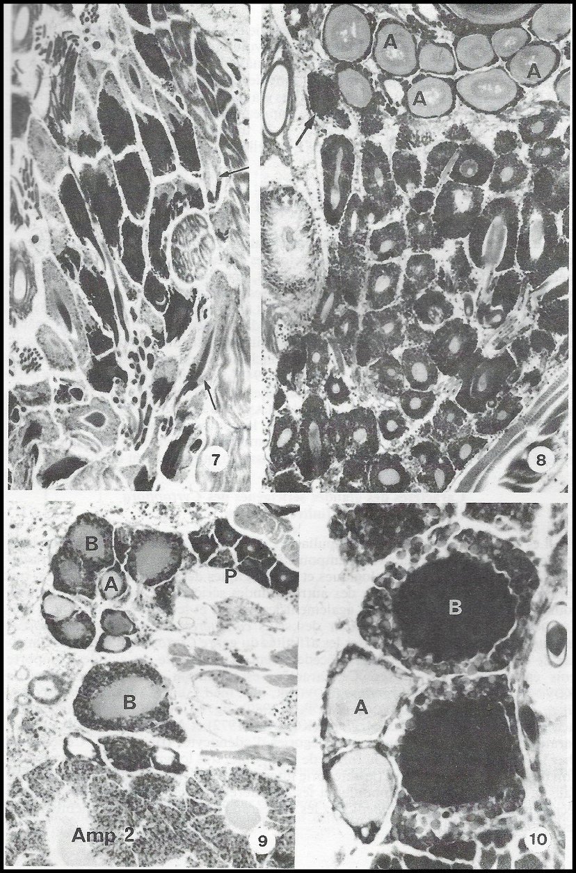 Annexe, Cyrtophora appareil séricigène 2