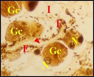 Botryoide im. 3