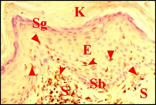 Cel.Langherans 2