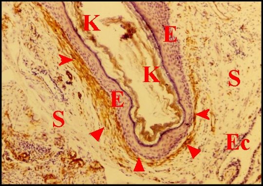 Cholé, myofibr.1