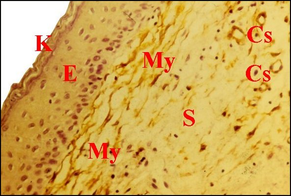 Cholé, Myofibr. 2