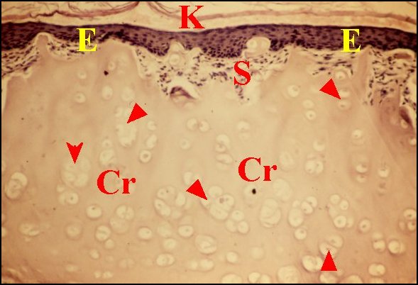 Cholé,cartilage 1