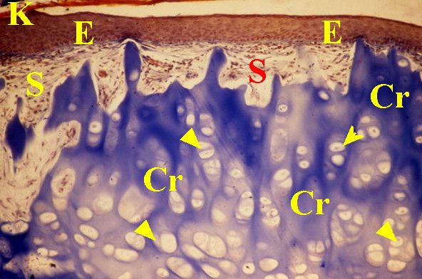 Cholé cartilage 2