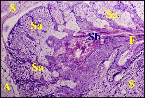 Choristome, sébacées 1