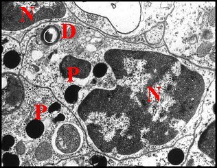 Cognatus canal 1