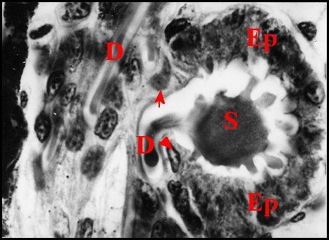 Collet prgon. quadratus