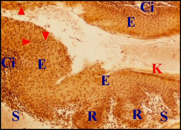 Cretes, exocytose