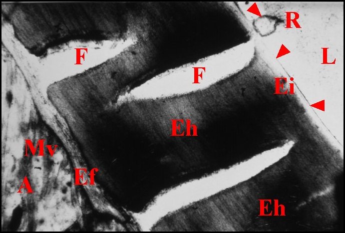 Cuticula araniella 2