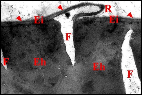 Cuticule cognatus 2