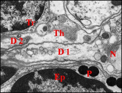 Dendrite 1