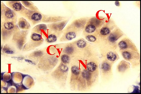 Endocrinode immature 2