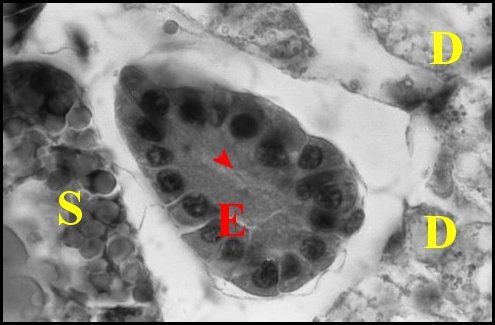 Endocrinode mle 2