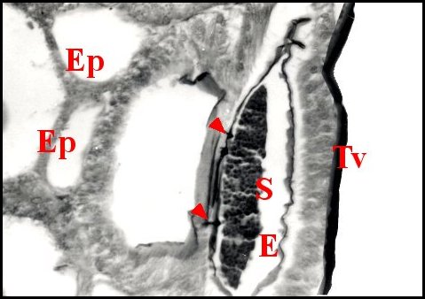 Epigastrique Pholcus