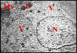 EpithÃ©lium Hersilia 1