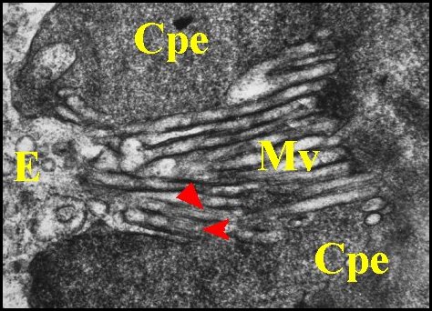 EpithÃ©lium Pholcus 3