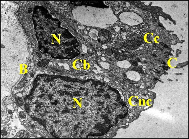 Epithélium caisse1