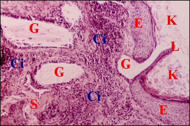 Epith.pseudo-gl.2