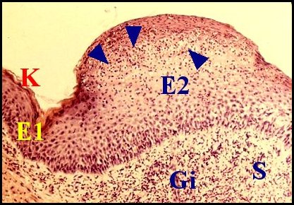 Exocytose, spongiose