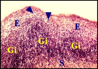 Exocytose