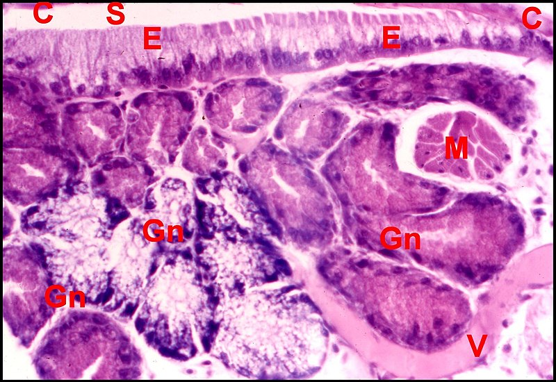 Araniella gnathocoxe