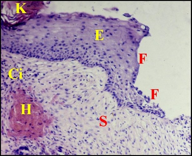 Front cholé 1