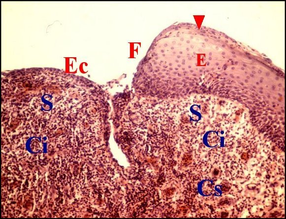 Front cholé 3