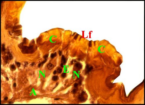 Histo lyriforme