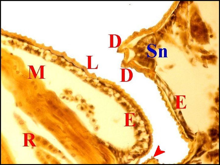 Histo.strid.fissifront. 1