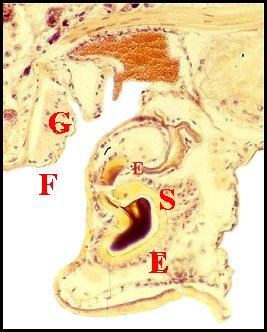 Histologie épigastrique totale