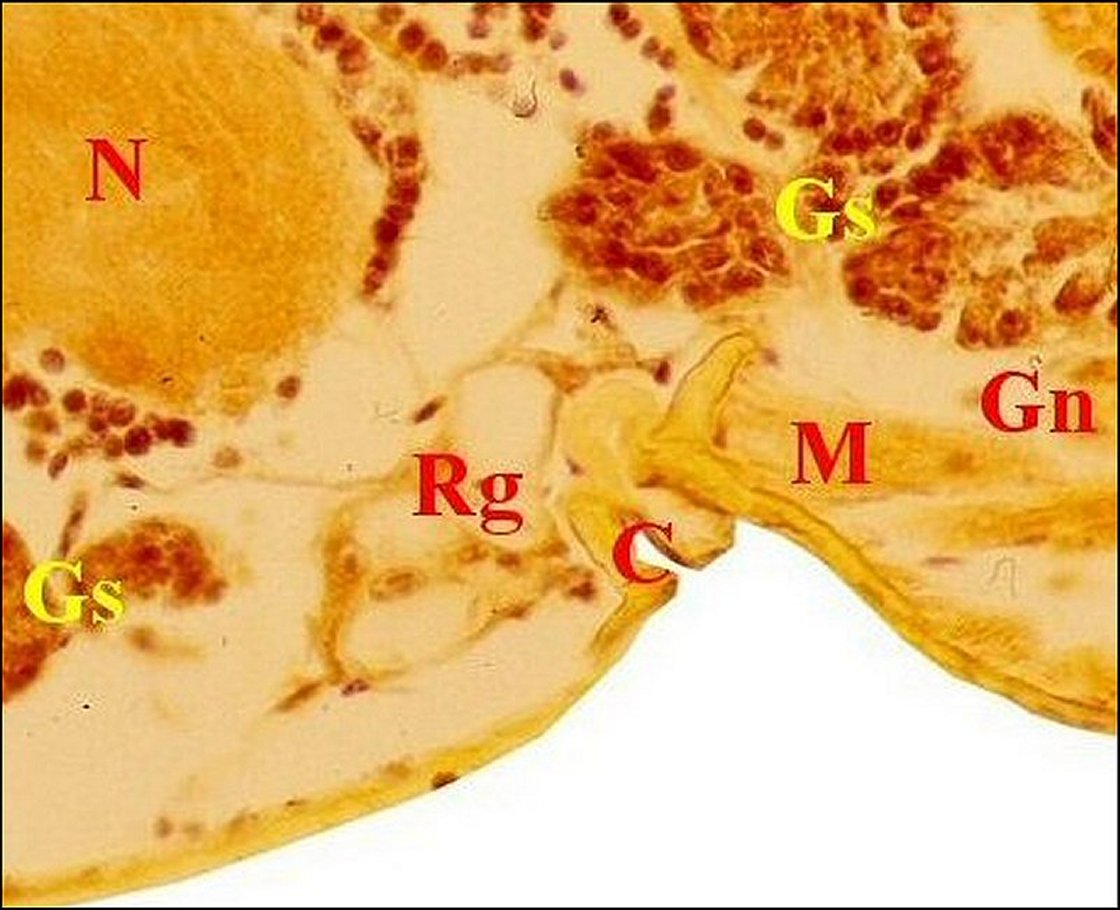 Leptyphantes  rtrognath