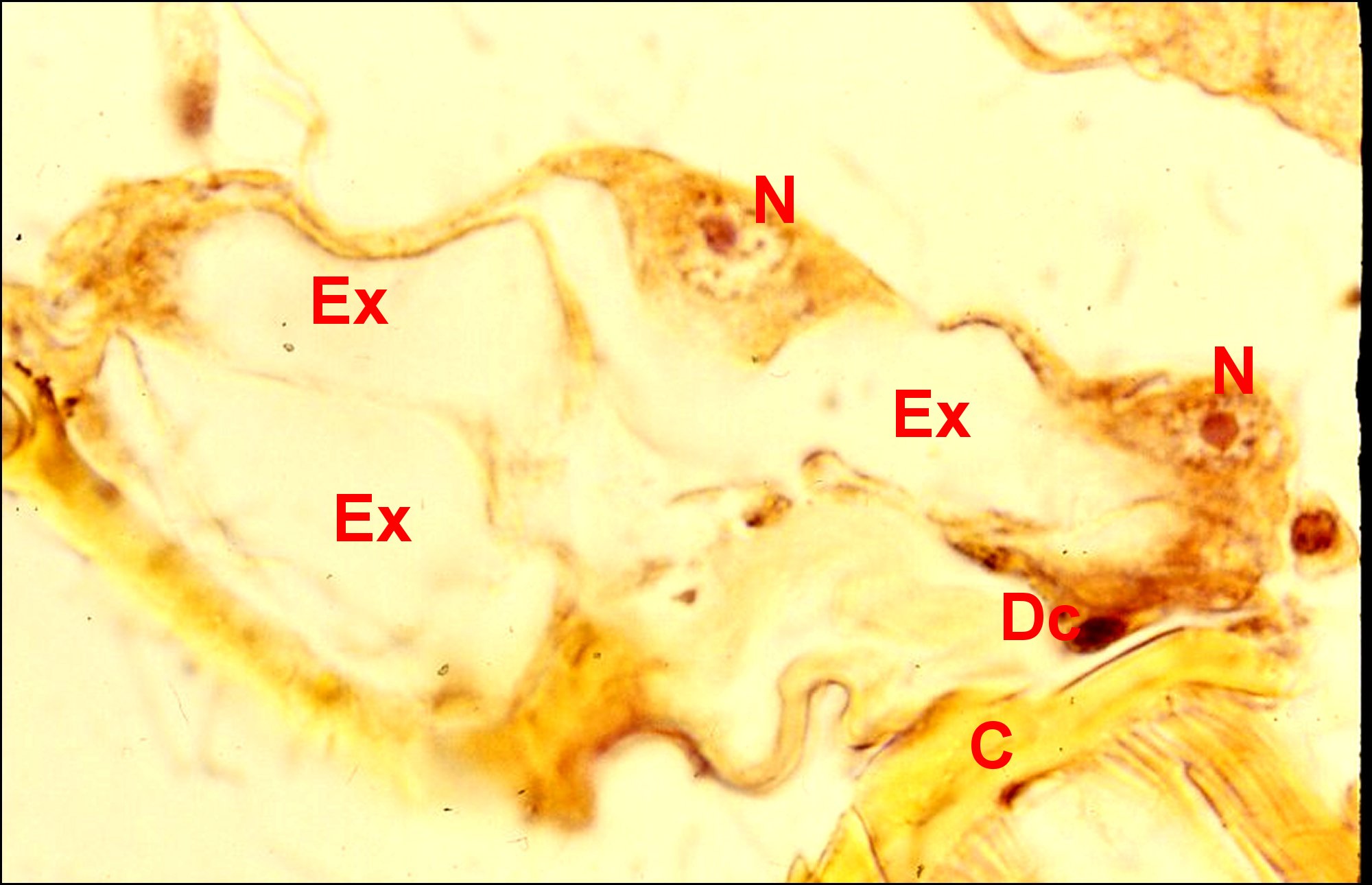 Leptyphantes dtail 1