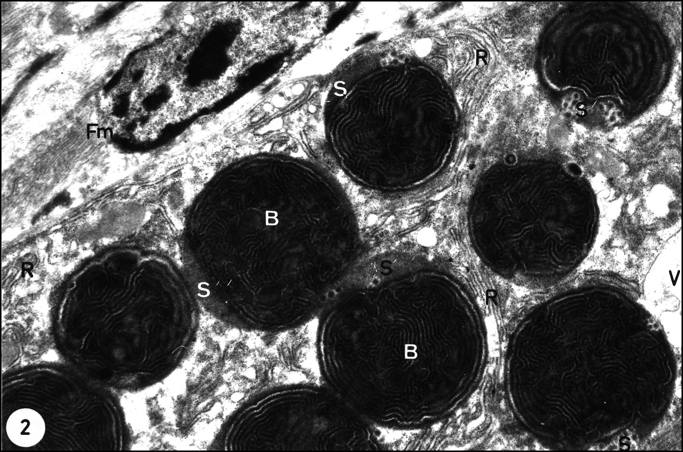 Linyphia frut.grains sexuelles