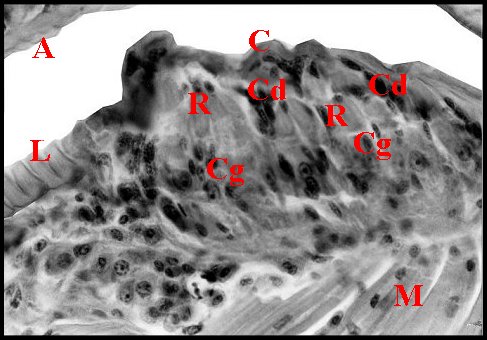 Lyriforme glande 1