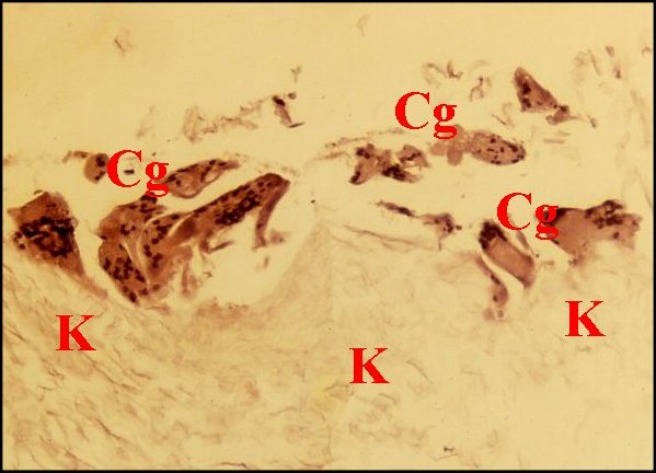 Macrophages, kératine 1