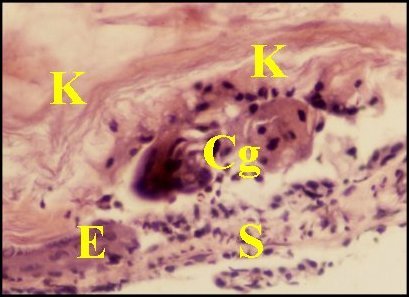 Macrophages, kératine 2