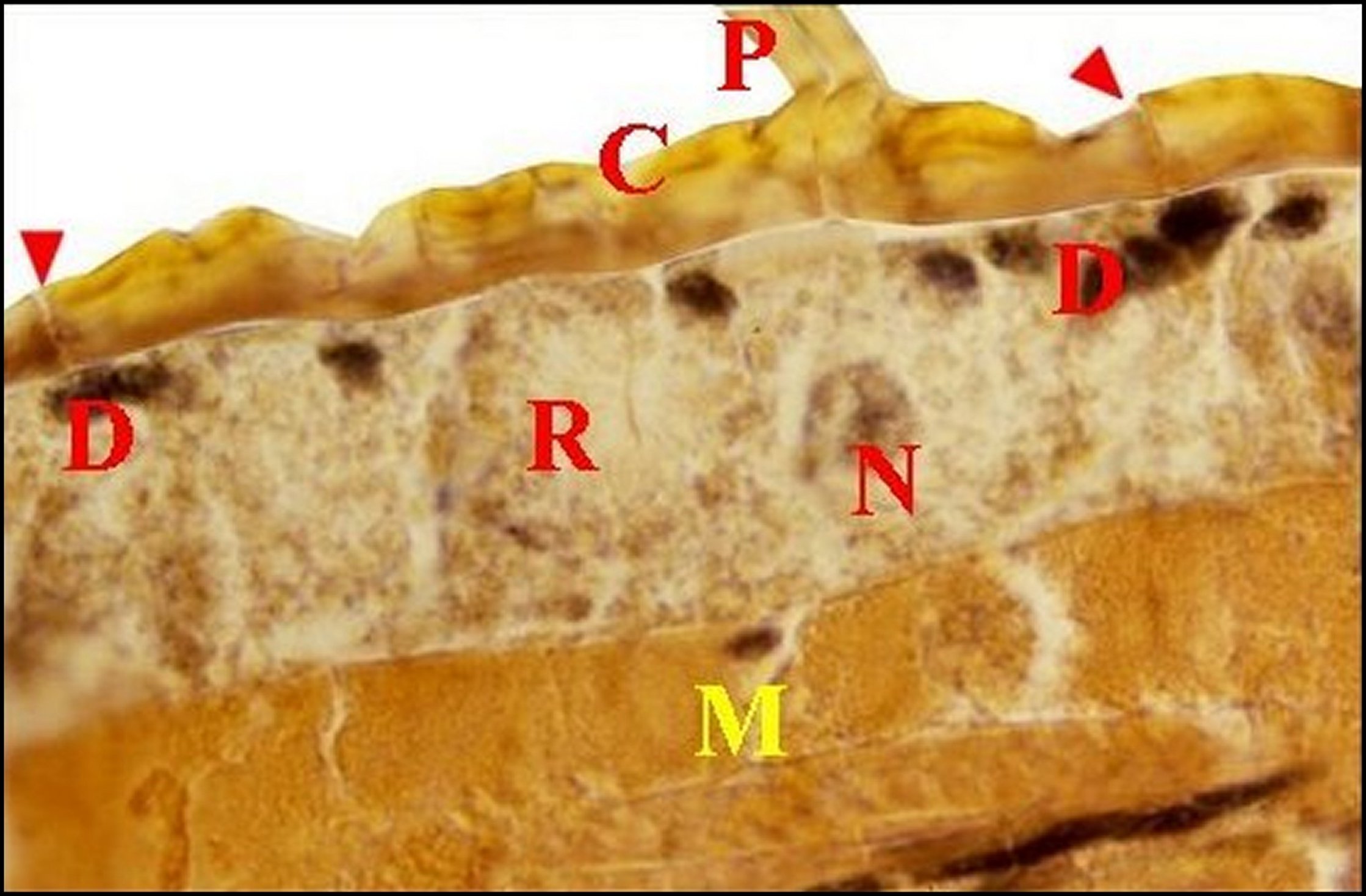 Mastophora 13