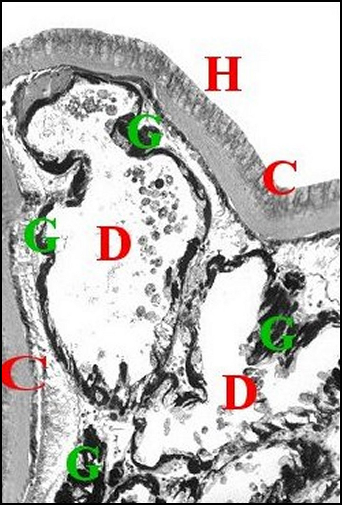 Mastophora 31