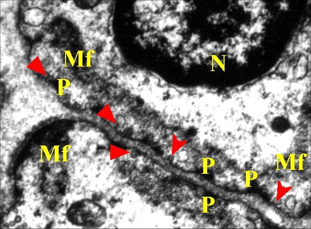 Myofibroblastes 3