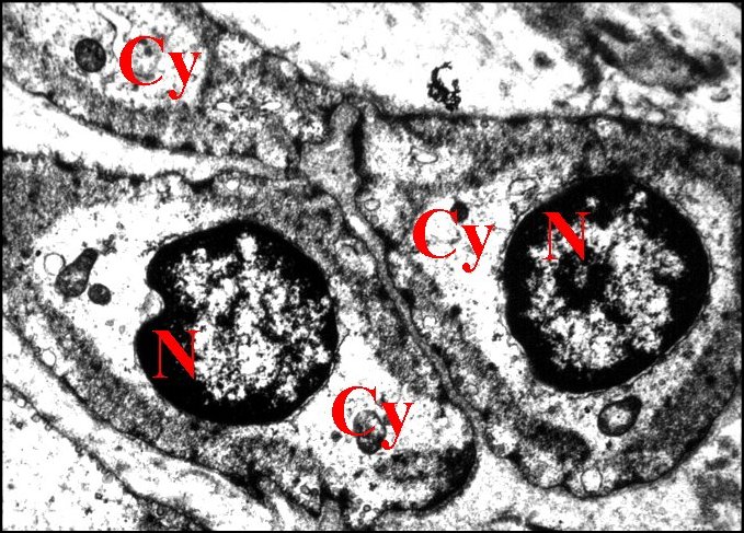 Myofibroblastes 1