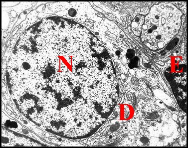 Neurone lyriforme