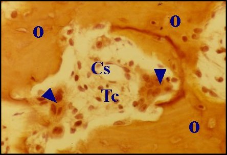 Ostéoclastes 2