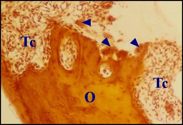 Ostéoclastes 3