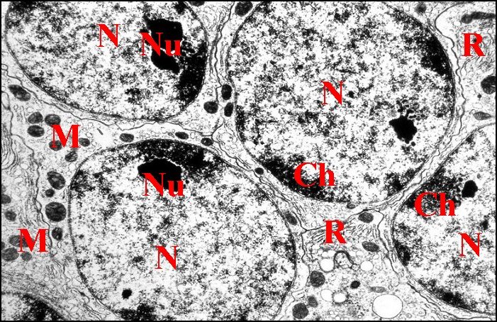 Petits adénocytes, noyaux