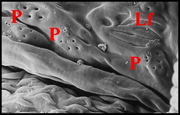 Pores, lyrifissures 1