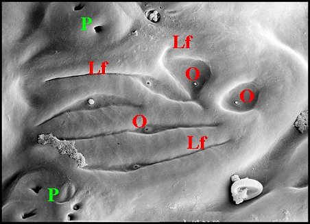 Pores, lyrifissures 2