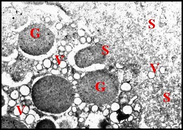 Pregon.Pholcus MET 4