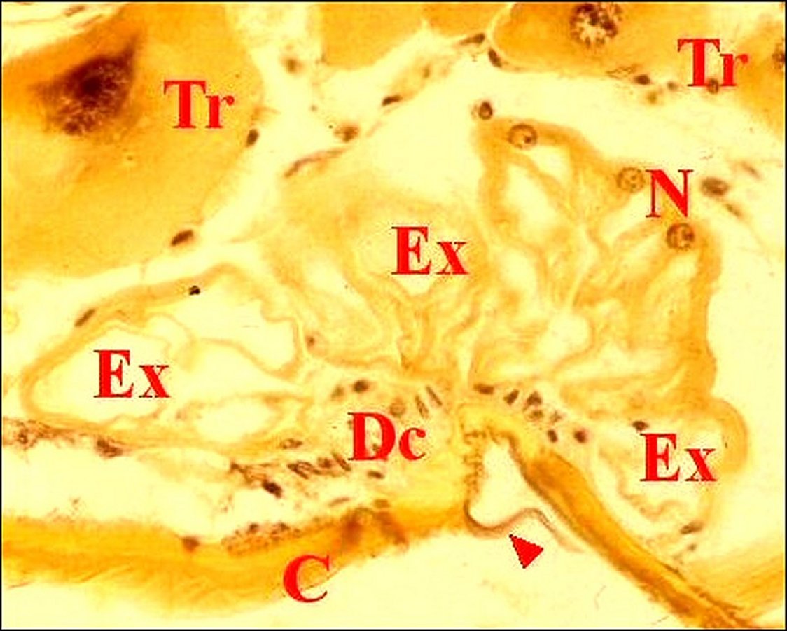 Retrognathocoxale Argyrodes 2