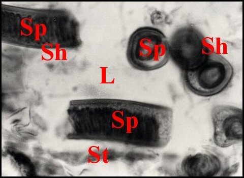 Spermathque Apneumonella 3